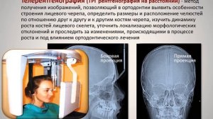 5.6в Лучевые методы диагностики