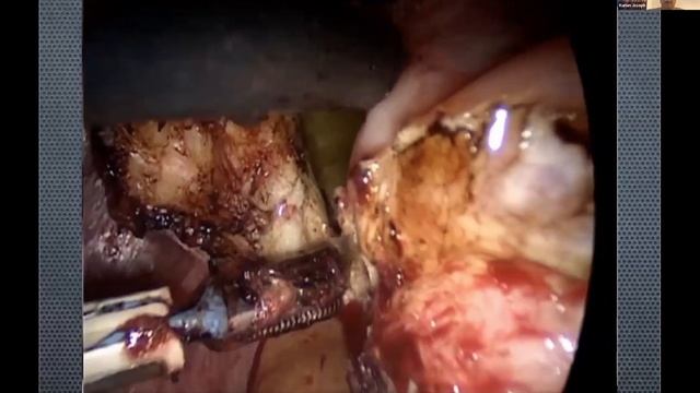 ICOG Masterclass Gynaecology 10 02 2023 смотреть онлайн
