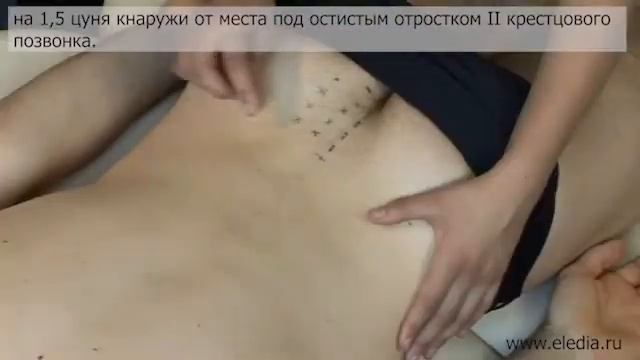 Цистит смотреть онлайн