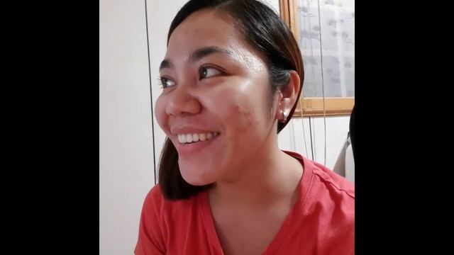 Centellian 24 (madeca Derma) Short Review