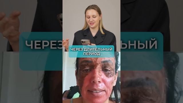 ЧТО С ЕЕ ЛИЦОМ?! #уходзакожей #лицо #пилинг #отек смотреть онлайн