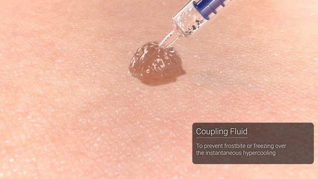 reepot Laser 3D Promotion Video for Pigment Disease смотреть онлайн