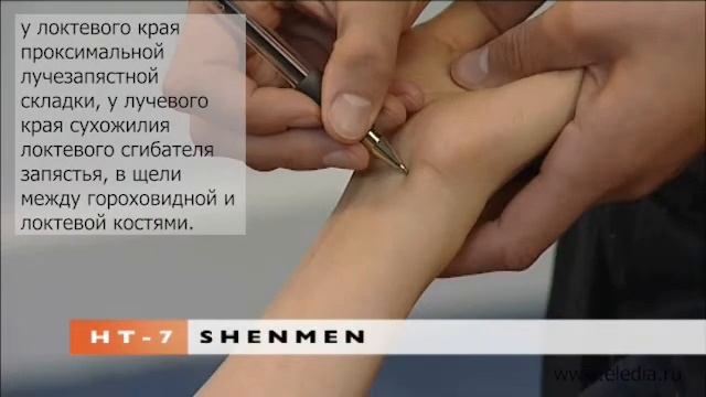 Стенокардия смотреть онлайн