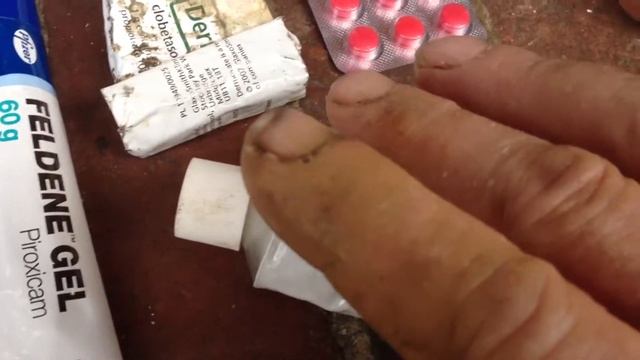 Finger injury with extreme allergic reaction Meds смотреть онлайн