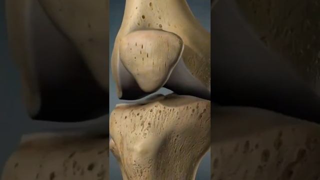 Колено l ЧТО МЫ ЛЕЧИМ l Остеоартрит #osteoarthritis #колено #боль #остеоартри #коленный #сустав смотреть онлайн
