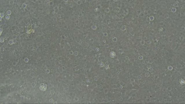 Treating External Bacterial Infections On Skin And Gills With Sera Phyto Med Baktazid