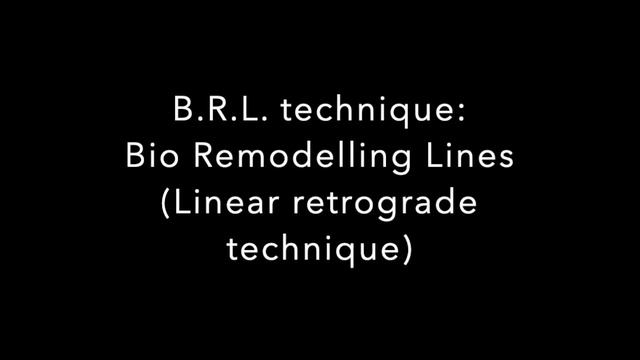 Nucleofill Techniques To Inject For Professionals