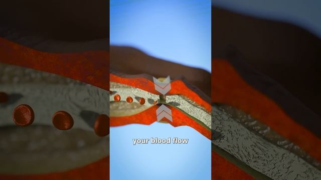 How A Ring Becomes Entrapped 💍🖐️ смотреть онлайн