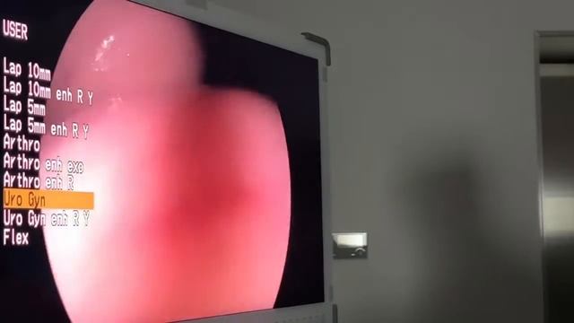 АЁЛЛАРДА БЕПУШТЛИКНИ ЗАМОНАВИЙ ХИРУРГИЯ ЙЎЛИ БИЛАН ДАВОЛАШ "SEHAT" клиникасида йўлга қўйилди смотреть онлайн