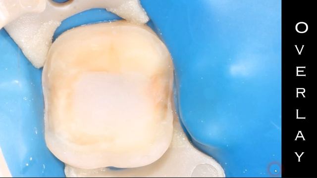 Ортопедия для начинающих смотреть онлайн