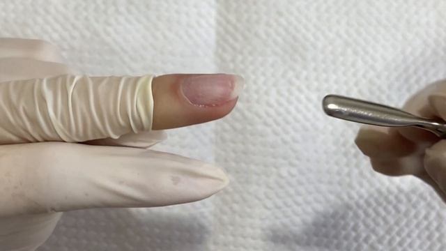 Como fazer um levantamento perfeito do bolso da cutícula смотреть онлайн