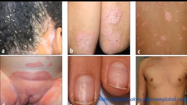 JEUNESSE SERUM RESERVE Before and After смотреть онлайн