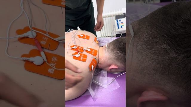 Иглотерапия с внутритканевой электростимуляцией часть 3 смотреть онлайн