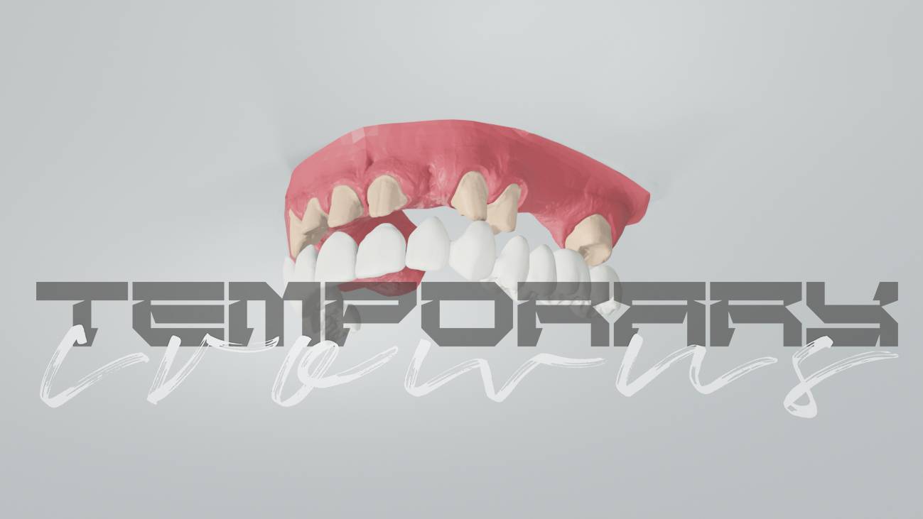 Temporary Crowns Animation