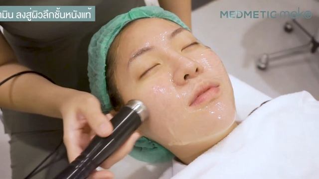 รีวิว เคล็ดลับหน้าใสของคุณอิมด้วย e-Derma Facial Treatment смотреть онлайн
