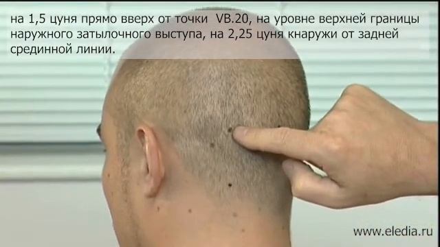 Энцефалит смотреть онлайн