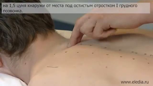 Миозит, миалгия смотреть онлайн
