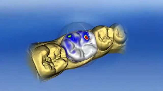 Cerec 4.0 Intro.mp4 смотреть онлайн