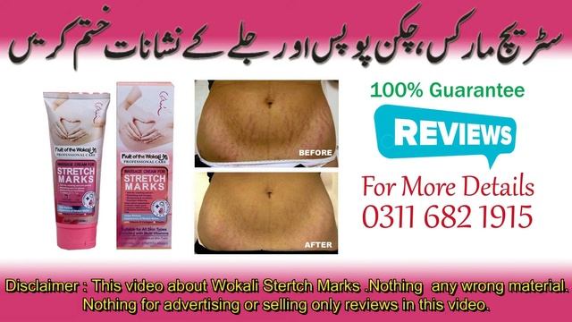 Fruit Of The Wokali Stretch Marks Cream | Reviews | Benefits In Urdu смотреть онлайн