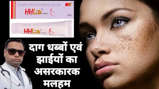 Ointment for melasma। HH lite ointment review Hydroquinone, Tretinoin & Mometasone cream। uses। смотреть онлайн