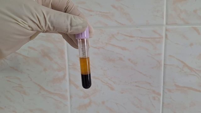 Что такое хилёз наглядно смотреть онлайн