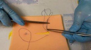 Кожный шов. Шов по Донати