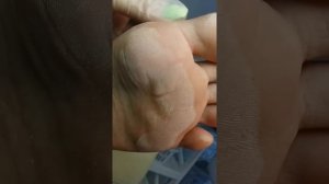 Педикюр🌺Обработка стопы, трещины