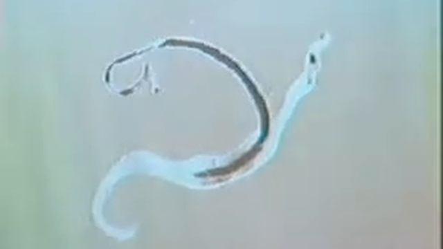 Schistosoma adults.avi смотреть онлайн