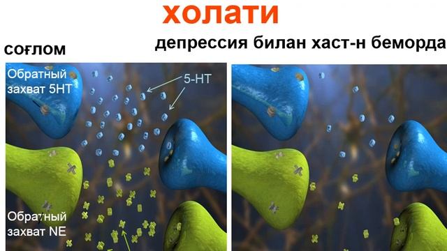 Аффектив бузилишлар. Депрессиялар. смотреть онлайн