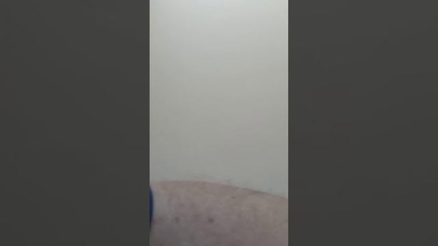 Приём у хирурга. Сызрань. смотреть онлайн