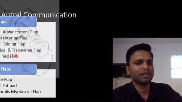 Maxillary Sinus & its Implications - Part 2 смотреть онлайн