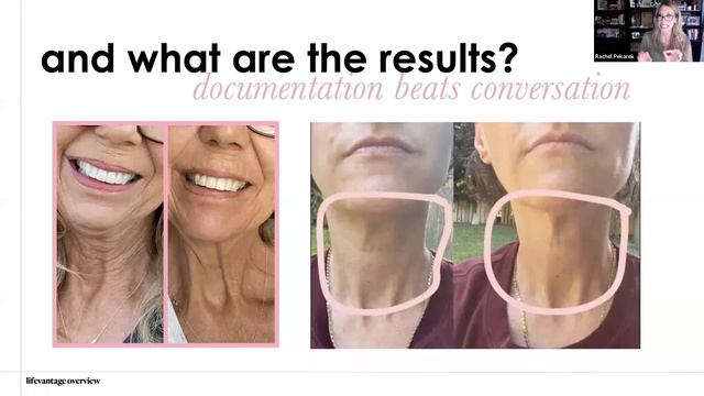 LifeVantage Overview - True Science Liquid Collagen смотреть онлайн