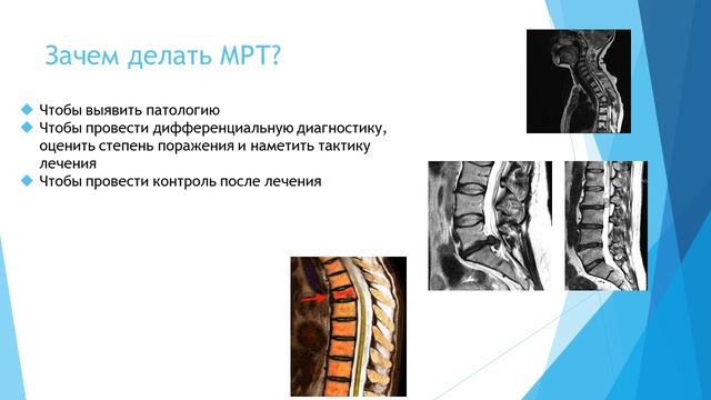 Лекция Основы лучевой диагностики Часть 2 смотреть онлайн