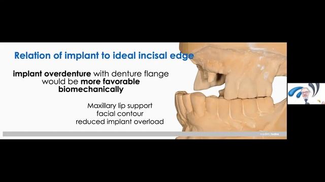 Dr. Nadim Z. Baba - Updates On New Materials For The Restoration Of Full Arch Rehabilitations