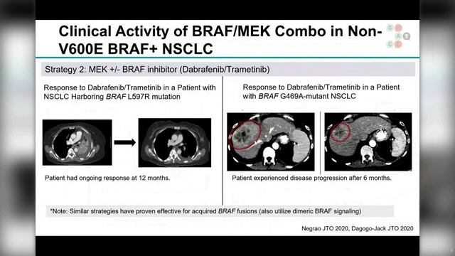 BRAF+ Disease: BRAF/MEK Combo in Other Mutations - 2022 Program: Targeted Therapies Forum смотреть онлайн
