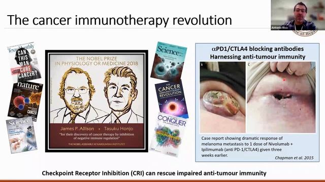 YW2023: ‘’Immunomodulatory Strategies for ALD: Why, How and When?‘’ - Dr. Antonio Riva смотреть онлайн