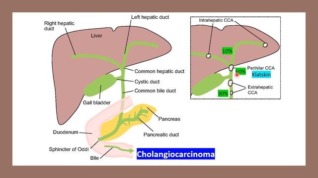 Obstructive Jaundice 2 1 смотреть онлайн