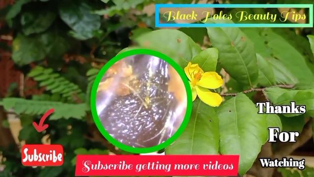 VERY STUBBORN HAIRY EAR WAX REMOVAL , earwax Removals смотреть онлайн