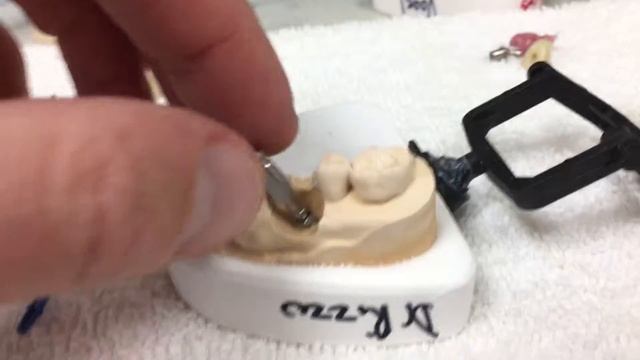 Neodent implant placed on an angle. NeoDent try-in abutment kit. 17 degree angulated abutment смотреть онлайн