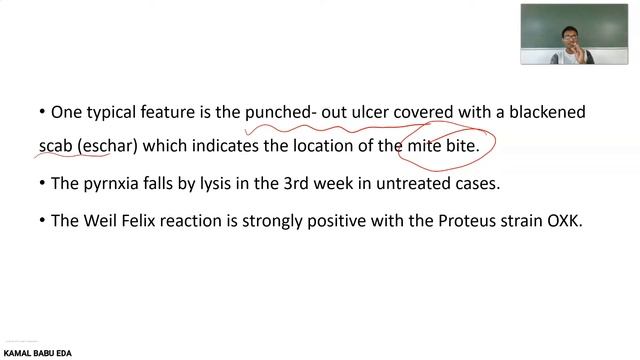 RICKTTESIAL ZOONOSIS [SCRUB TYPHUS,MURINE TYPHUS,INDIAN TICK TYPHUS] смотреть онлайн