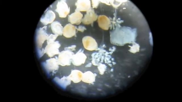 Unionid byssal threads смотреть онлайн