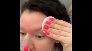 Биоревитализация в домашних условиях. Дмае интрамускулярно.