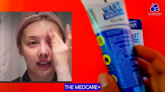 Wart Remover Ointment L Wart Remover Kaise Use Kare #youtube #skinwarts #wartremover