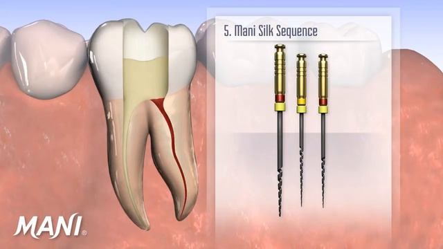 Mani Silk Nickel Titanium Endodontic Instrumentation System смотреть онлайн
