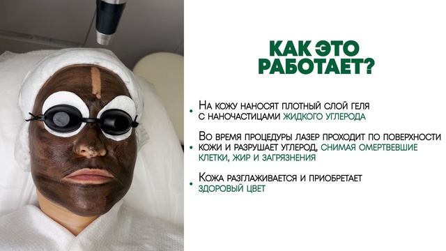 Карбоновый лазерный пилинг смотреть онлайн
