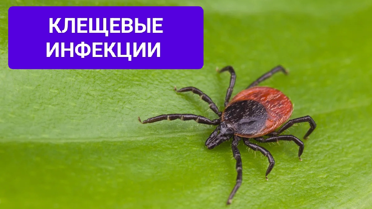 Клещевые инфекции (вирусный клещевой энцефалит, иксодовый клещевой боррелиоз)