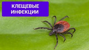 Клещевые инфекции (вирусный клещевой энцефалит, иксодовый клещевой боррелиоз)
