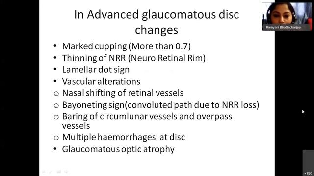 Observation of World Glaucoma Day 2021 смотреть онлайн