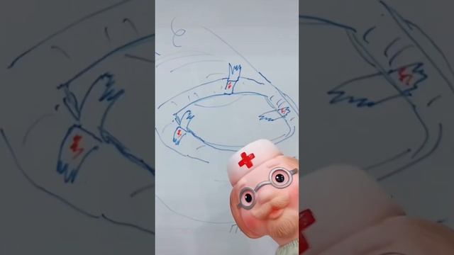 Заусенец 😅 смотреть онлайн