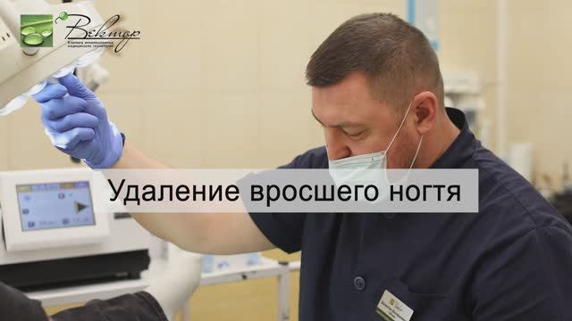 Удаление вросшего ногтя CO2-лазером смотреть онлайн